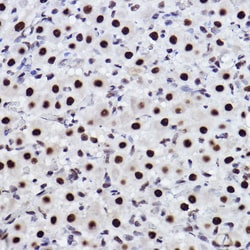 Invitrogen CtBP2 Recombinant Rabbit Monoclonal Antibody (1R1U6) 100 &mu;L;