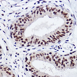 Invitrogen GTF2I Recombinant Rabbit Monoclonal Antibody (5B6D1) 100 &mu;L;