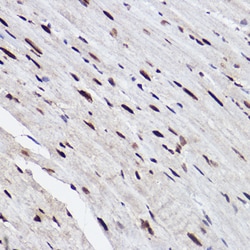 Invitrogen GTF2I Recombinant Rabbit Monoclonal Antibody (5B6D1) 100 &mu;L;