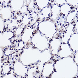 Invitrogen GTF2I Recombinant Rabbit Monoclonal Antibody (5B6D1) 100 &mu;L;