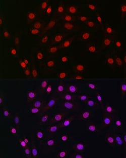 Invitrogen HDGF Recombinant Rabbit Monoclonal Antibody (5U7A7) 100 &mu;L;