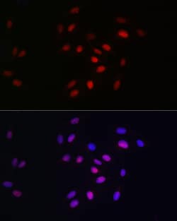 Invitrogen HDGF Recombinant Rabbit Monoclonal Antibody (5U7A7) 100 &mu;L;