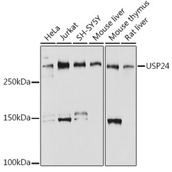 Invitrogen USP24 Recombinant Rabbit Monoclonal Antibody (7K7N2) 100 &mu;L;