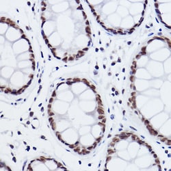 Invitrogen MED4 Recombinant Rabbit Monoclonal Antibody (8T5C9) 100 &mu;L;