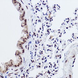 Invitrogen MED4 Recombinant Rabbit Monoclonal Antibody (8T5C9) 100 &mu;L;