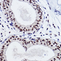 Invitrogen SNRPA1 Recombinant Rabbit Monoclonal Antibody (2D7M1) 100 &mu;L;