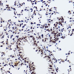Invitrogen SNRPA1 Recombinant Rabbit Monoclonal Antibody (2D7M1) 100 &mu;L;