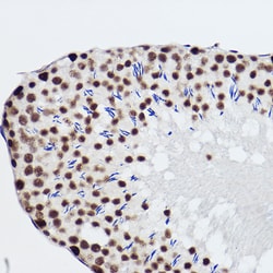 Invitrogen SNRPA1 Recombinant Rabbit Monoclonal Antibody (2D7M1) 100 &mu;L;