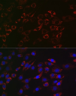 Invitrogen ACAA2 Recombinant Rabbit Monoclonal Antibody (8H6H5) 100 &mu;L;