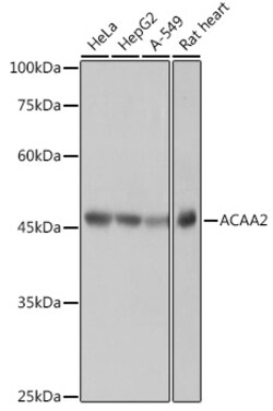 Invitrogen ACAA2 Recombinant Rabbit Monoclonal Antibody (8H6H5) 100 &mu;L;