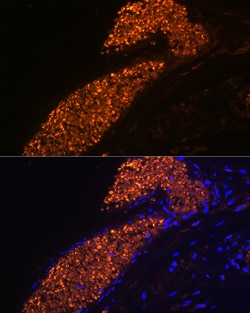 Invitrogen Hemoglobin gamma-1 Recombinant Rabbit Monoclonal Antibody (1R9T7)