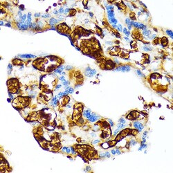 Invitrogen Hemoglobin gamma-1 Recombinant Rabbit Monoclonal Antibody (6F1A8)