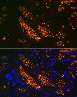 Invitrogen Hemoglobin gamma-1 Recombinant Rabbit Monoclonal Antibody (6F1A8)