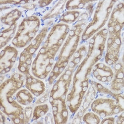 Invitrogen ERLIN2 Recombinant Rabbit Monoclonal Antibody (9T3M5) 100 &mu;L;