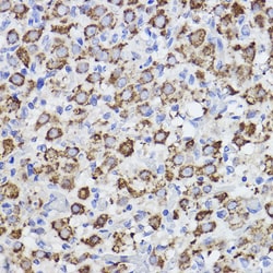 Invitrogen ERLIN2 Recombinant Rabbit Monoclonal Antibody (9T3M5) 100 &mu;L;