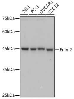 Invitrogen ERLIN2 Recombinant Rabbit Monoclonal Antibody (9T3M5) 100 &mu;L;