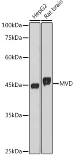Invitrogen MVD Recombinant Rabbit Monoclonal Antibody (7G4B9) 100 &mu;L;