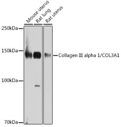 Invitrogen Collagen III Recombinant Rabbit Monoclonal Antibody (6Y9C6)