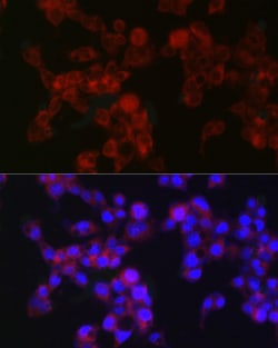 Invitrogen MGST1 Recombinant Rabbit Monoclonal Antibody (6A0S5) 100 &mu;L;