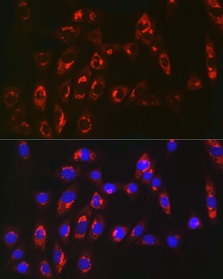 Invitrogen MGST1 Recombinant Rabbit Monoclonal Antibody (6A0S5) 100 &mu;L;