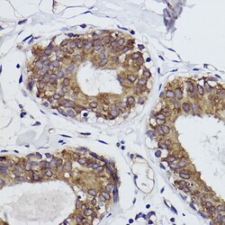 Invitrogen MGST1 Recombinant Rabbit Monoclonal Antibody (6A0S5) 100 &mu;L;