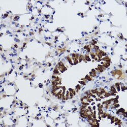 Invitrogen MGST1 Recombinant Rabbit Monoclonal Antibody (6A0S5) 100 &mu;L;