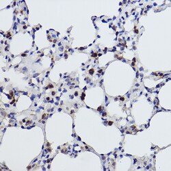 Invitrogen MGST1 Recombinant Rabbit Monoclonal Antibody (6A0S5) 100 &mu;L;