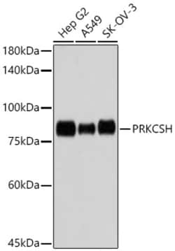 Invitrogen PRKCSH Recombinant Rabbit Monoclonal Antibody (4Z3K3) 100 &mu;L;