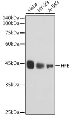 Invitrogen HFE Recombinant Rabbit Monoclonal Antibody (2O7D2) 100 &mu;L;