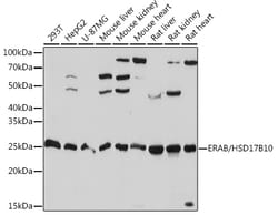 Invitrogen ERAB Recombinant Rabbit Monoclonal Antibody (3O4W10) 100 &mu;L;