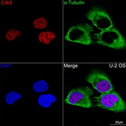 Invitrogen CDK9 Recombinant Rabbit Monoclonal Antibody (1C4E3) 100 &mu;L;