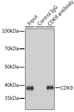 Invitrogen CDK9 Recombinant Rabbit Monoclonal Antibody (1C4E3) 100 &mu;L;