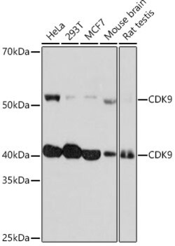 Invitrogen CDK9 Recombinant Rabbit Monoclonal Antibody (1C4E3) 100 &mu;L;