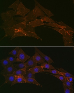 Invitrogen&trade;&nbsp;Sodium Potassium ATPase Recombinant Rabbit Monoclonal Antibody (3L6F0)