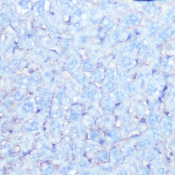 Invitrogen Sodium Potassium ATPase Recombinant Rabbit Monoclonal Antibody