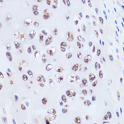Invitrogen Aggrecan Recombinant Rabbit Monoclonal Antibody (6L4T2) 100