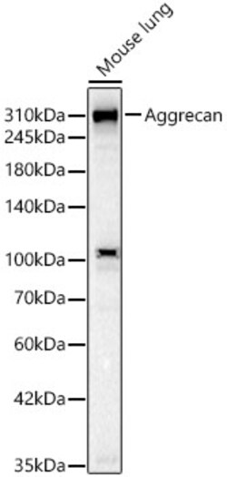Invitrogen Aggrecan Recombinant Rabbit Monoclonal Antibody (6L4T2) 100
