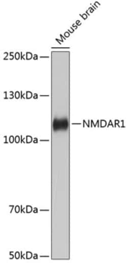 Invitrogen NMDAR1 Recombinant Rabbit Monoclonal Antibody (1H1T3) 100 &mu;L | Buy Online | Invitrogen&trade; | Fisher Scientific