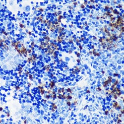 Invitrogen S100A8 Recombinant Rabbit Monoclonal Antibody (5Z7U8) 100 &mu;L;