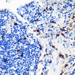 Invitrogen S100A8 Recombinant Rabbit Monoclonal Antibody (5Z7U8) 100 &mu;L;