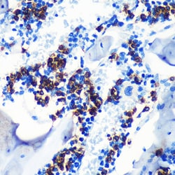 Invitrogen S100A8 Recombinant Rabbit Monoclonal Antibody (5Z7U8) 100 &mu;L;