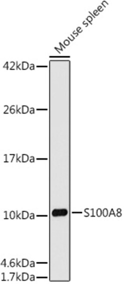 Invitrogen S100A8 Recombinant Rabbit Monoclonal Antibody (5Z7U8) 100 &mu;L;