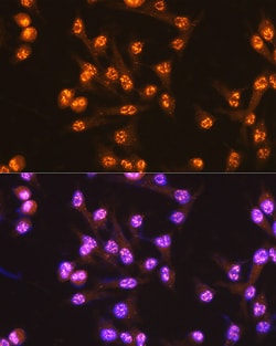 Invitrogen CDC25C Recombinant Rabbit Monoclonal Antibody (6R0I6) 100 &mu;L | Buy Online | Invitrogen&trade; | Fisher Scientific