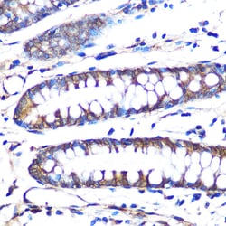 Invitrogen Aromatase Recombinant Rabbit Monoclonal Antibody (5C5N7) 100