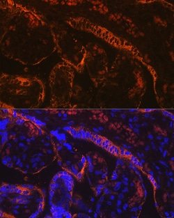 Invitrogen Aromatase Recombinant Rabbit Monoclonal Antibody (5C5N7) 100