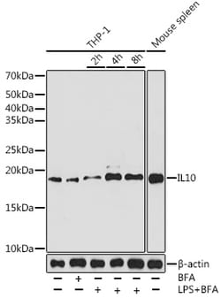 Invitrogen IL-10 Recombinant Rabbit Monoclonal Antibody (6U0G7) 100 &mu;L;