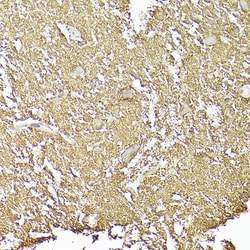 Invitrogen CD90 (Thy1) Recombinant Rabbit Monoclonal Antibody (2V9S6) 100