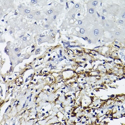 Invitrogen CD90 (Thy1) Recombinant Rabbit Monoclonal Antibody (2V9S6) 100
