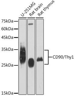 Invitrogen CD90 (Thy1) Recombinant Rabbit Monoclonal Antibody (2V9S6) 100