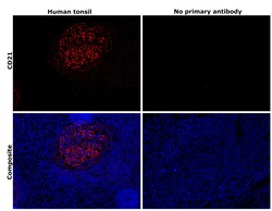 Invitrogen CD21 Recombinant Rabbit Monoclonal Antibody (1T2Z9) 100 &mu;L | Buy Online | Invitrogen&trade; | Fisher Scientific
